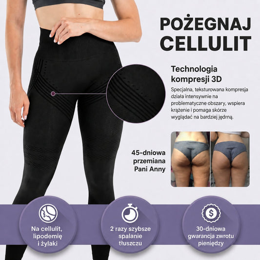 fitUp Legginsy 3D – Zmniejsz widoczność cellulitu i ciesz się gładszą sylwetką